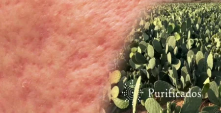prickly-pear-seed-oil-for-acne-scars-evidence-based-application-protocol