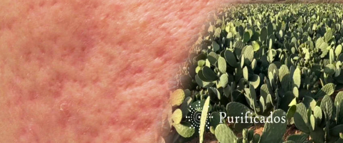 prickly-pear-seed-oil-for-acne-scars-evidence-based-application-protocol